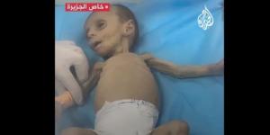 عاجل/ غزة: وفاة طفل نتيجة سوء التغذية وعدم توفّر العلاج